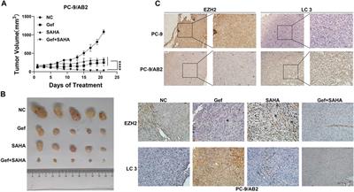 Combining EGFR-TKI With SAHA Overcomes EGFR-TKI-Acquired Resistance by Reducing the Protective Autophagy in Non-Small Cell Lung Cancer